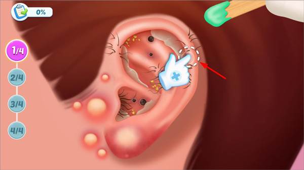 疯狂医院达什医生无限金币钻石版游戏截图4